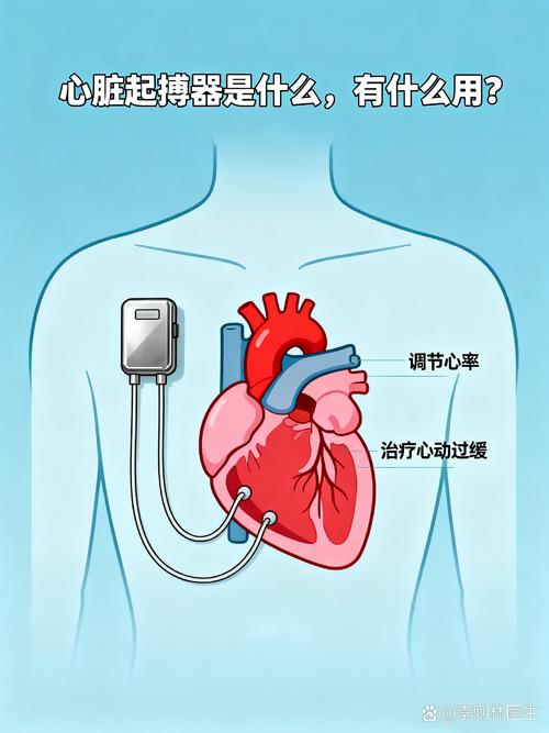 性欲低和心脏起搏器有关吗-示意图