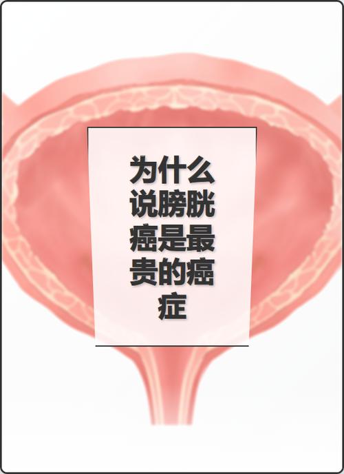 性欲低和膀胱癌治疗有关吗-相关配图